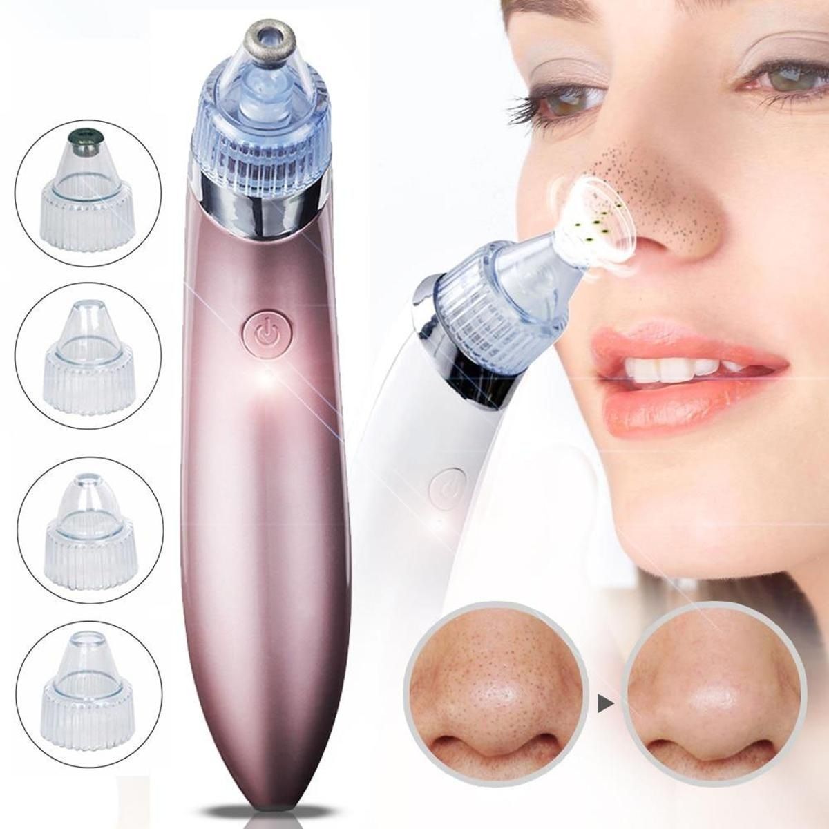 Chargeable Blackhead Removal Machine